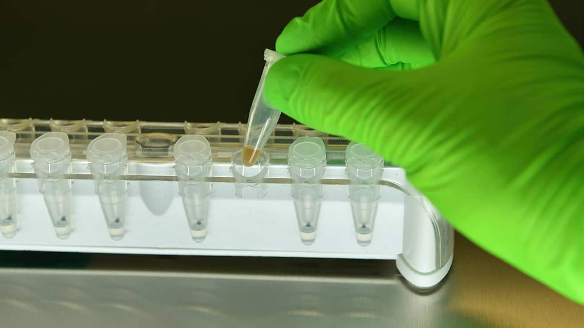 Biontech: Ermutigende Ergebnisse in Studie zu Lungenkrebs