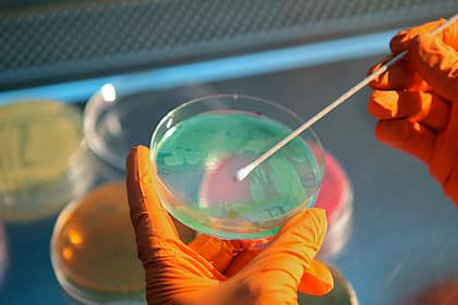 Kurspotenzial im SPI: Schweizer Aktien im Analystencheck Ein Basilea-Mitarbeiter entnimmt im Labor eine Probe.