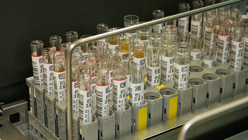 Teströhrchen warten auf den Untersuch im Labor.